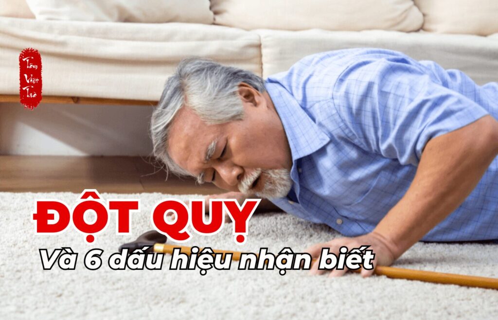 Đột quỵ và 6 dấu hiệu nhận biết