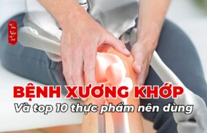 Bệnh xương khớp và top 10 thực phẩm nên dùng