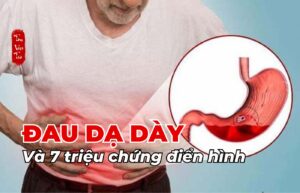 Đau dạ dày và 7 triệu chứng điển hình