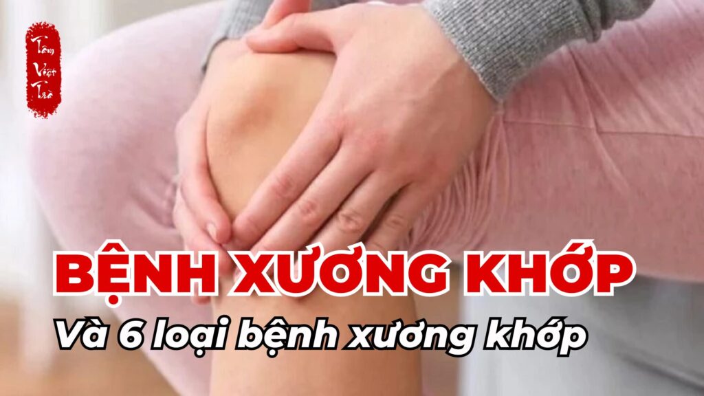 Bệnh xương khớp và 6 loại bệnh xương khớp thường gặp