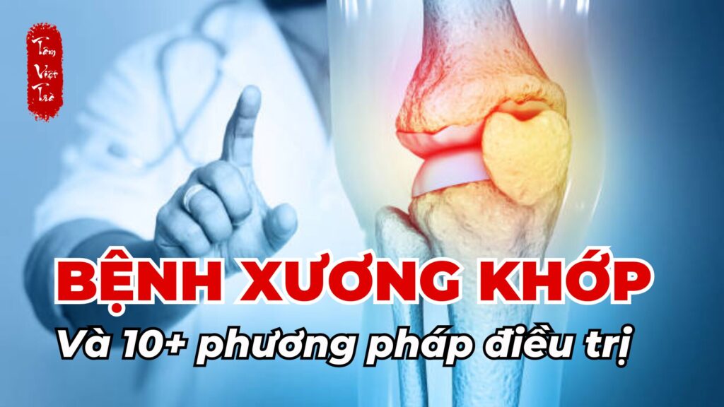 Bệnh xương khớp và 10+ phương pháp điều trị