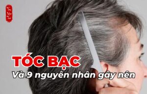 Tóc bạc và 9 nguyên nhân gây nên