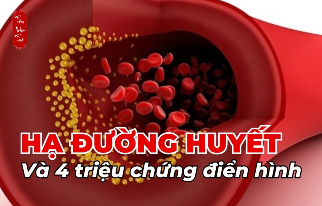 Hạ đường huyết và 4 triệu chứng điển hình