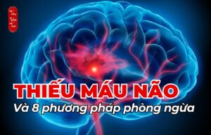 Thiếu máu não và 8 phương pháp phòng ngừa